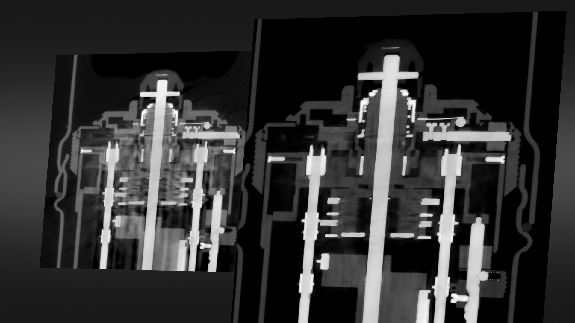 高級混合材料偽影減少（AMMAR）