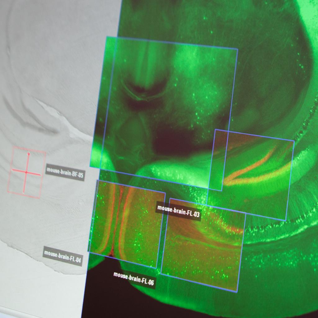 Zen Microphoto ZEISS ZEN Microscopy Software