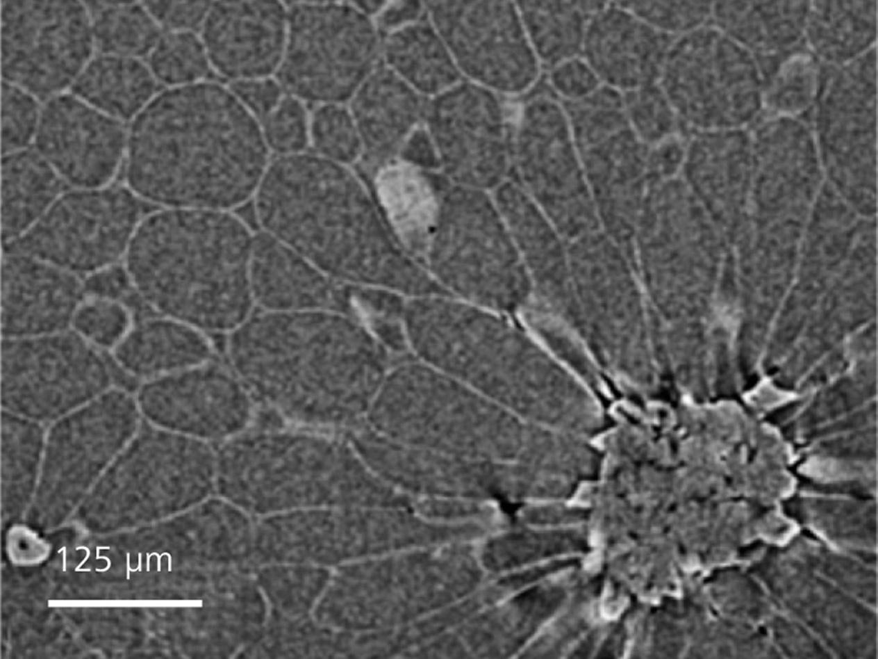 Pear imaged with phase contrast, showing details of cell walls in normal cells and stone cells (bottom). 