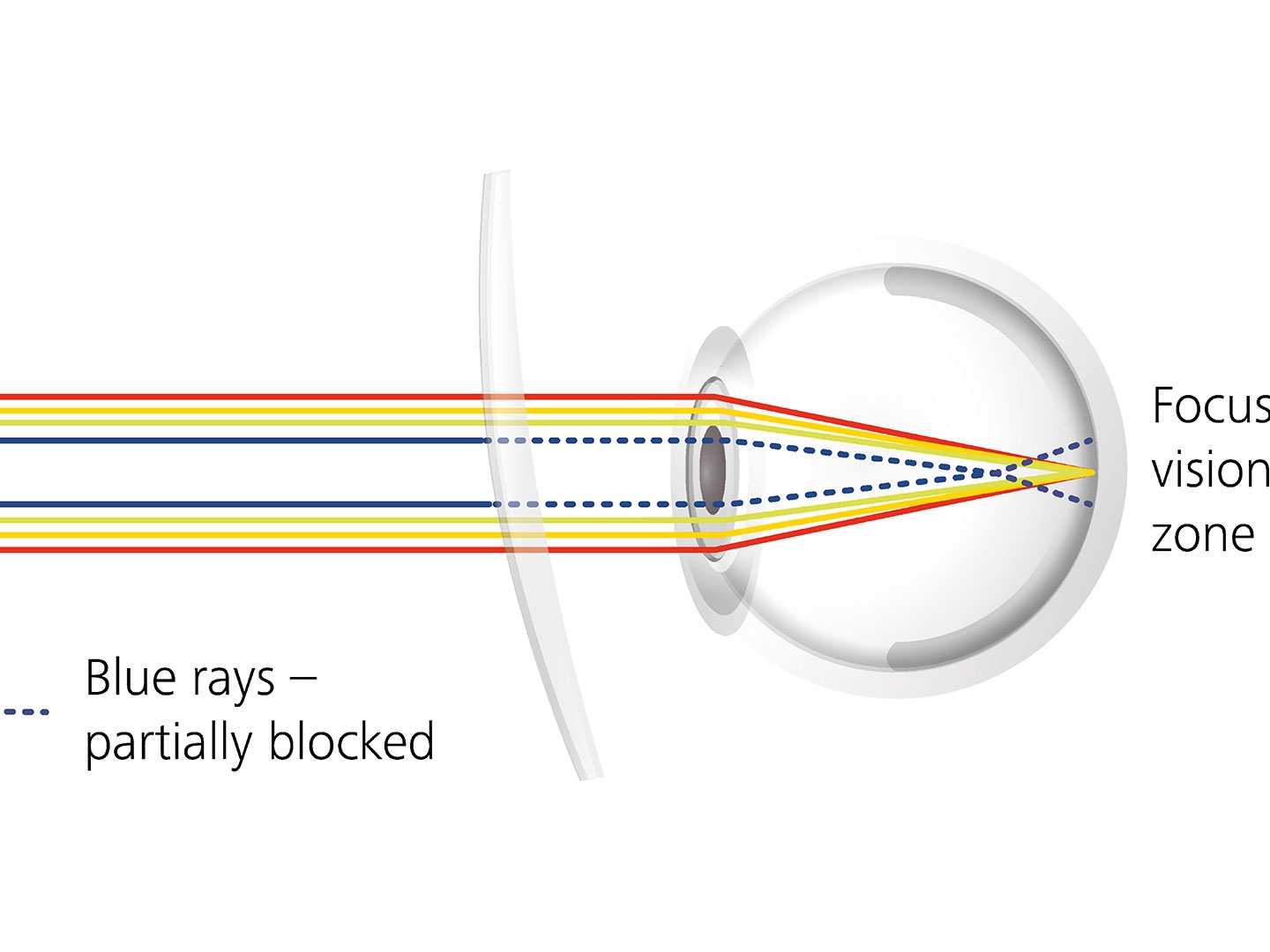 鏡片鍍膜如何藉由部分阻擋藍光來減少眩光的可視化 