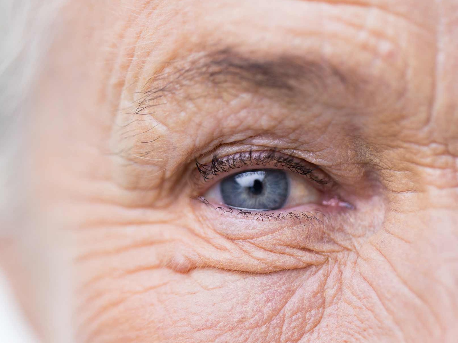 該圖片顯示了一隻不健康眼睛的特寫，說明了潛在的眼部附件危害。 
